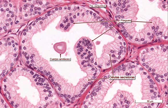 celulas de la prostata histologia)