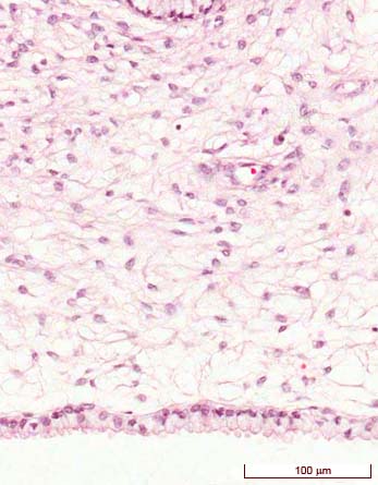 histología del endocérvix